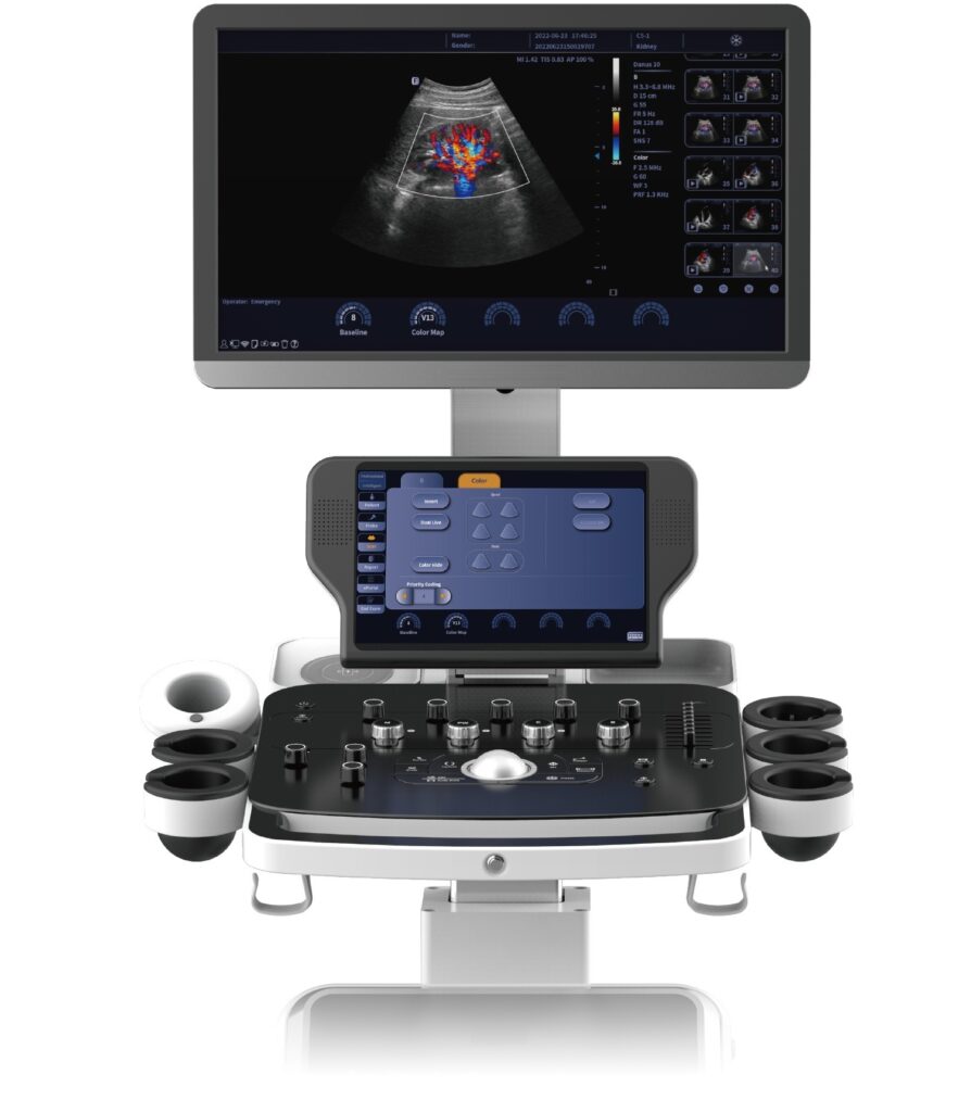 ultrasound